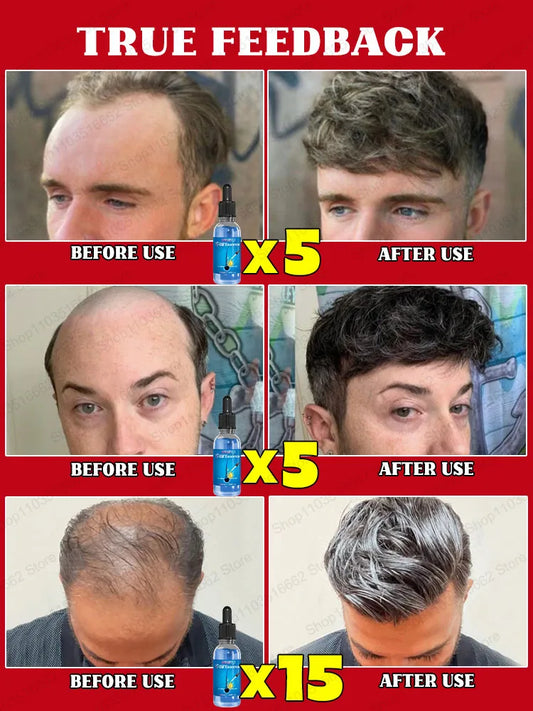 Cenvia™ Hair Growth Serum