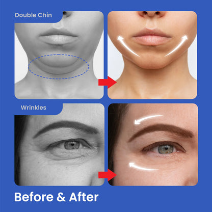 Cenvia™ Invisible Face-Lifting Tape